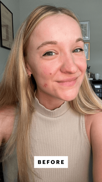 Herrick before applying the IT Cosmetics Your Skin But Better CC Cream With SPF 50